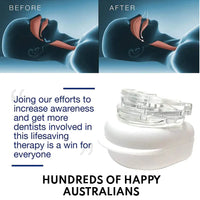 Anti-Snoring Mouthpiece